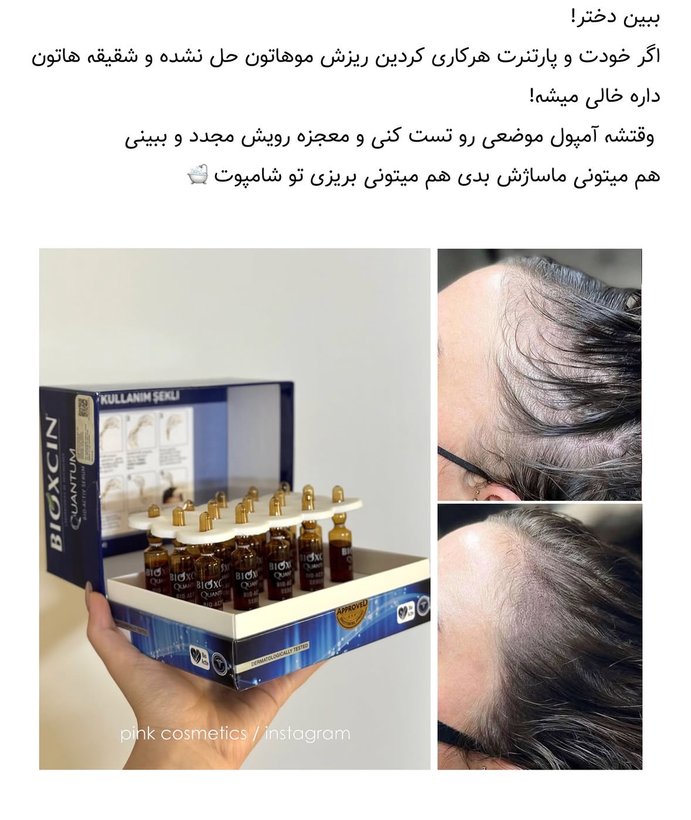 قطع ریزش مو