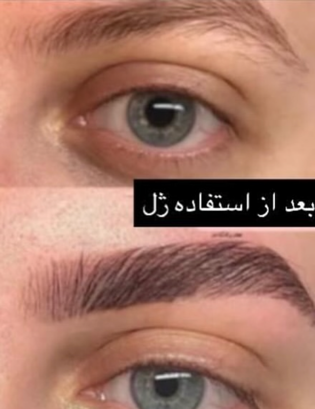 لیفت ابرو رنگی مورلی